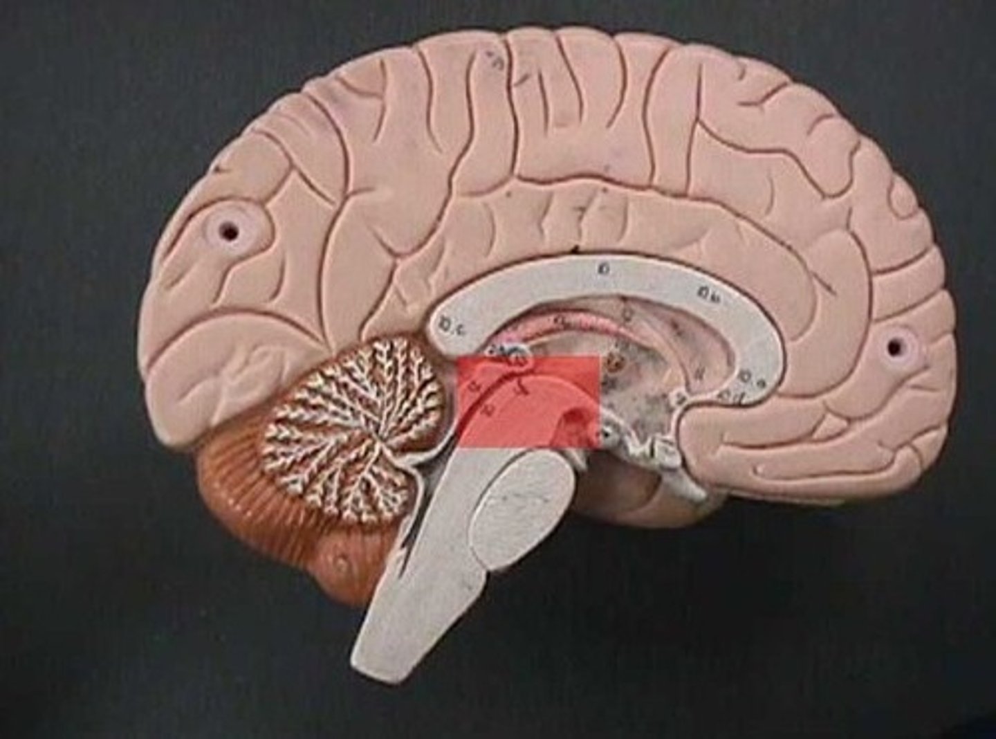 <p>Cerebral aqueduct, associated with CN III and IV</p>