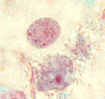 term image