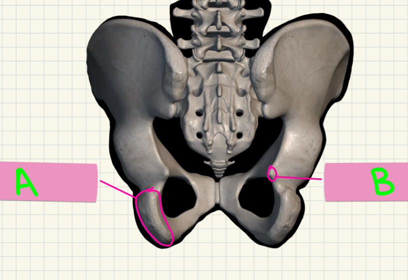 <p>A-B?</p>