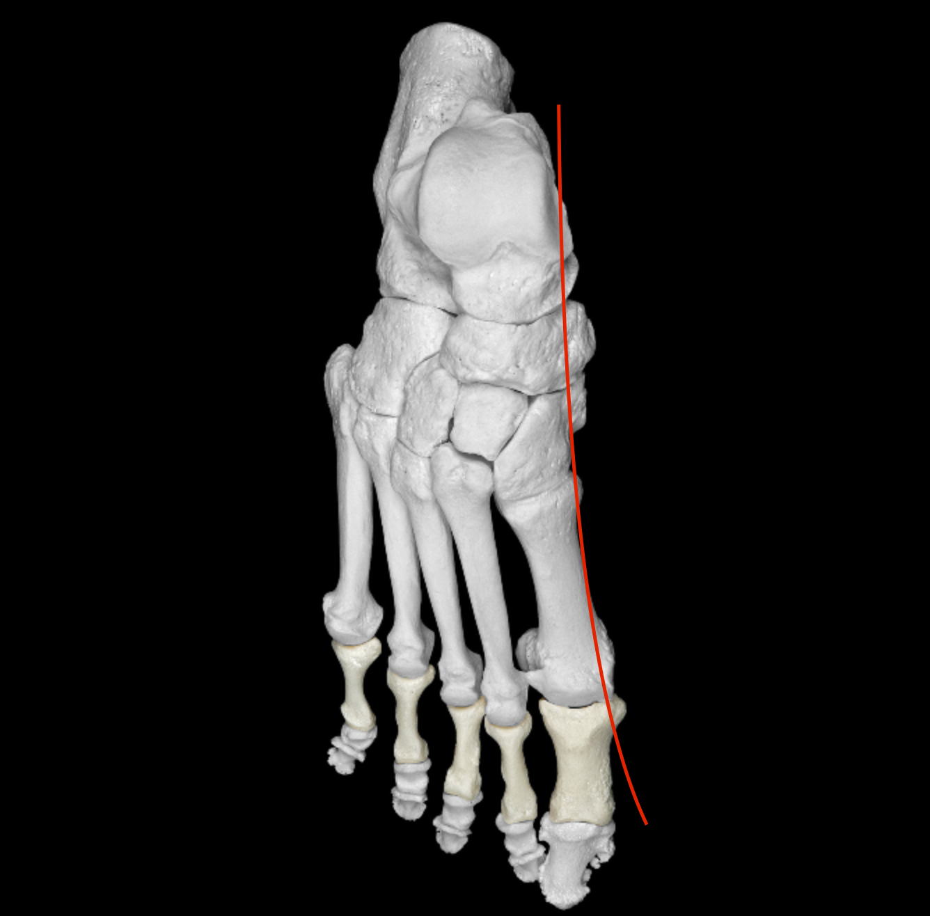 <p>bend from hallux to calcaneus on foot </p>
