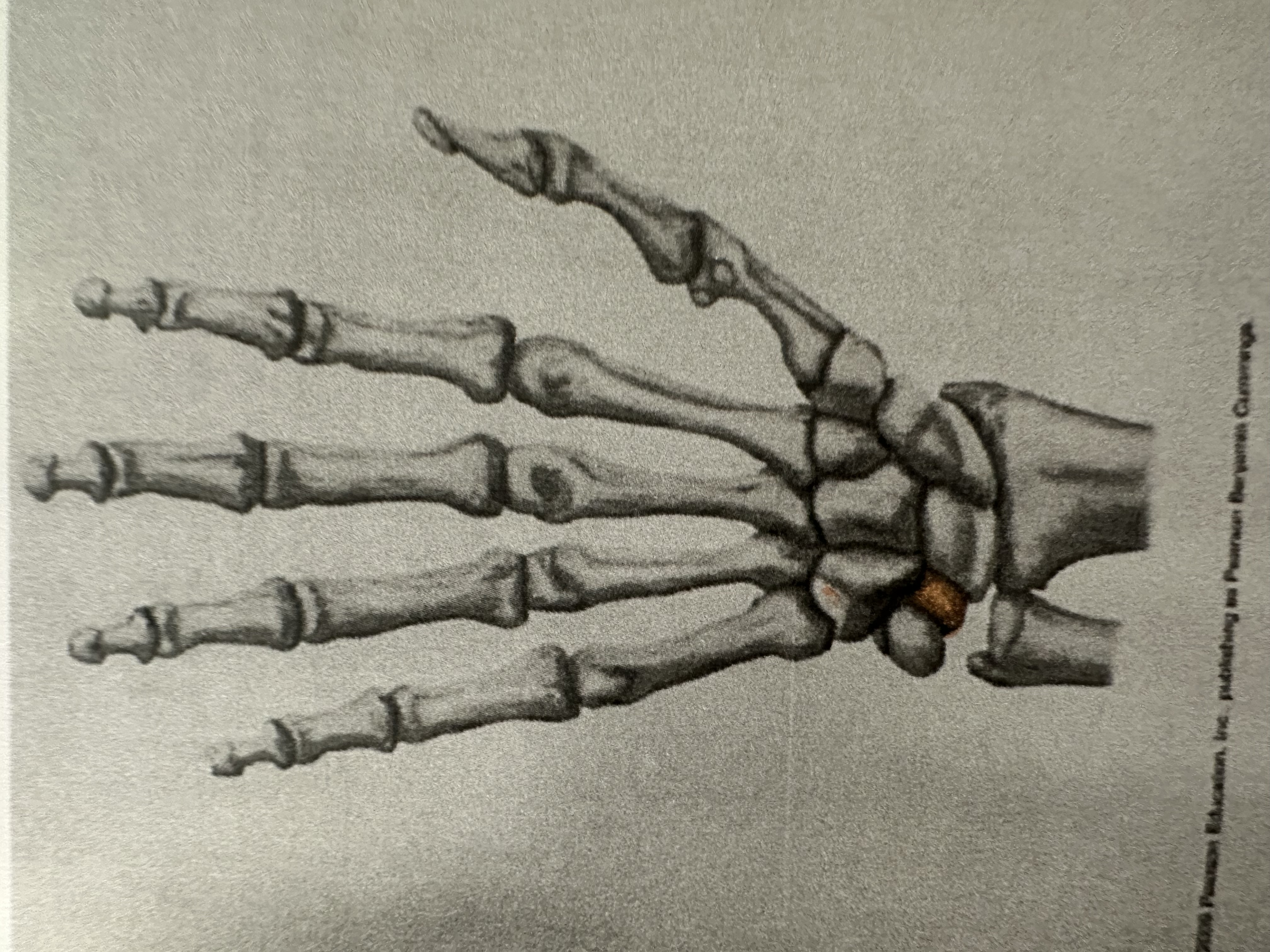 <p>Proximal Carpal Bone</p>