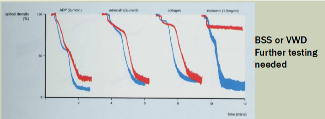 <ul><li><p><span>RIPA—Ristocetin-induced platelet agglutination</span></p><ul><li><p><span>Uses <strong>patients</strong> platelet rich plasma</span></p></li><li><p><span>Measures ability of ristocetin to induce agglutination of <strong>patient</strong> platelet rich plasma</span></p><ul><li><p><span>Detects patient's VWF binding to patient's GPIb/IX</span></p></li><li><p><span>Abnormal in both BSS and VWD</span></p></li></ul></li></ul></li></ul><p></p>