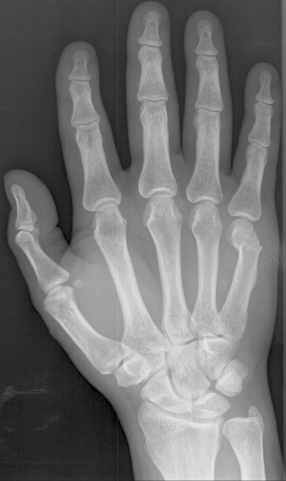<p>57-year-old man:</p><ul><li><p>found face-down outside a bar</p></li><li><p>poorly responsive and unable to provide a history</p></li><li><p>scattered abrasions over the arms and legs</p></li><li><p>swelling of the right hand</p></li></ul><p class="text-body wish-body-content wish-body-content-light dark:wish-body-content-dark break-words whitespace-break-spaces text-dark-text-100 dark:text-light-text-100 select-text"></p>