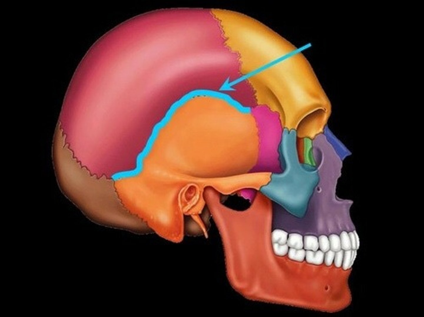 <p>between parietal and temporal bones on each side of skull</p>