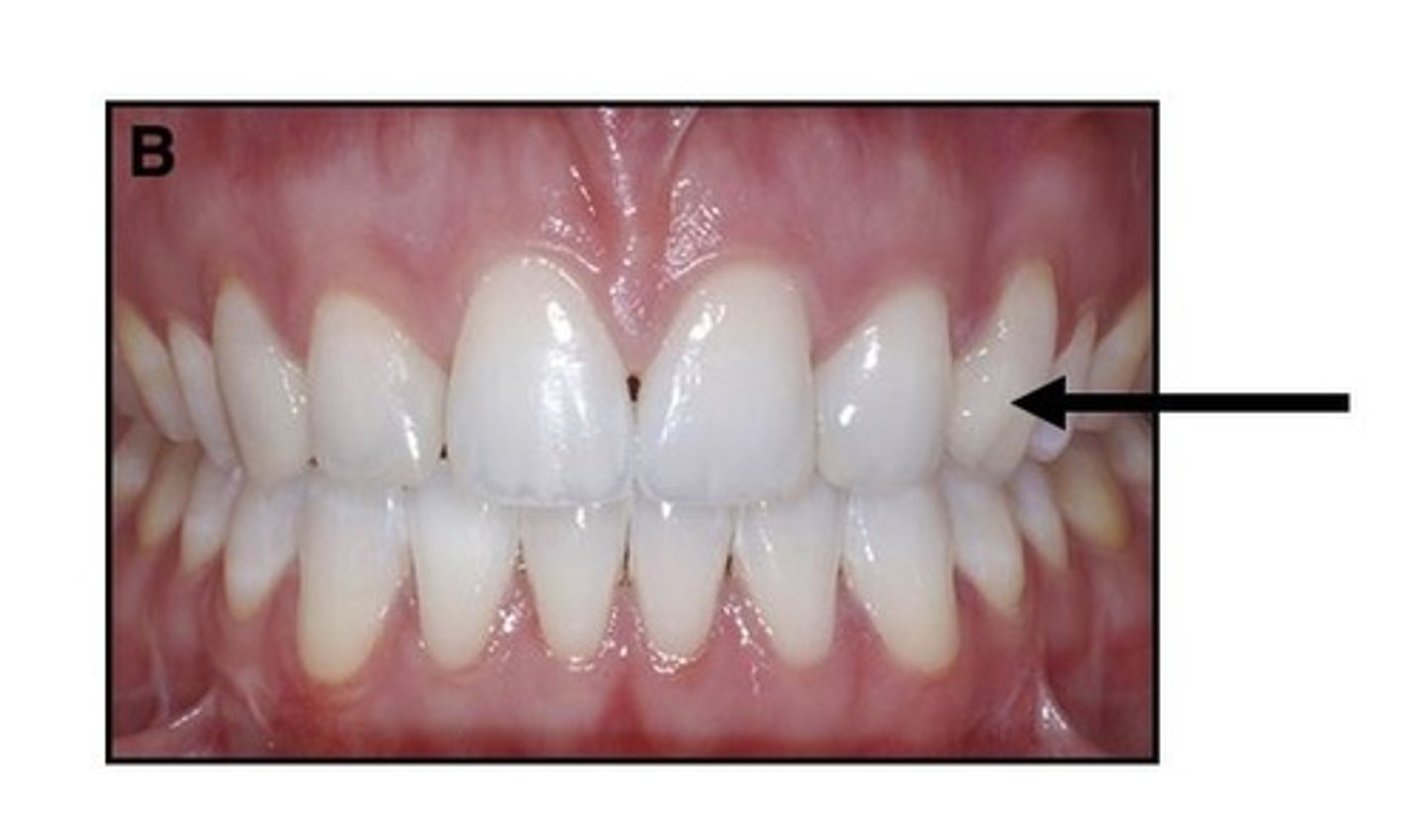 <p>Using the Universal Numbering System, what tooth number is this?</p>