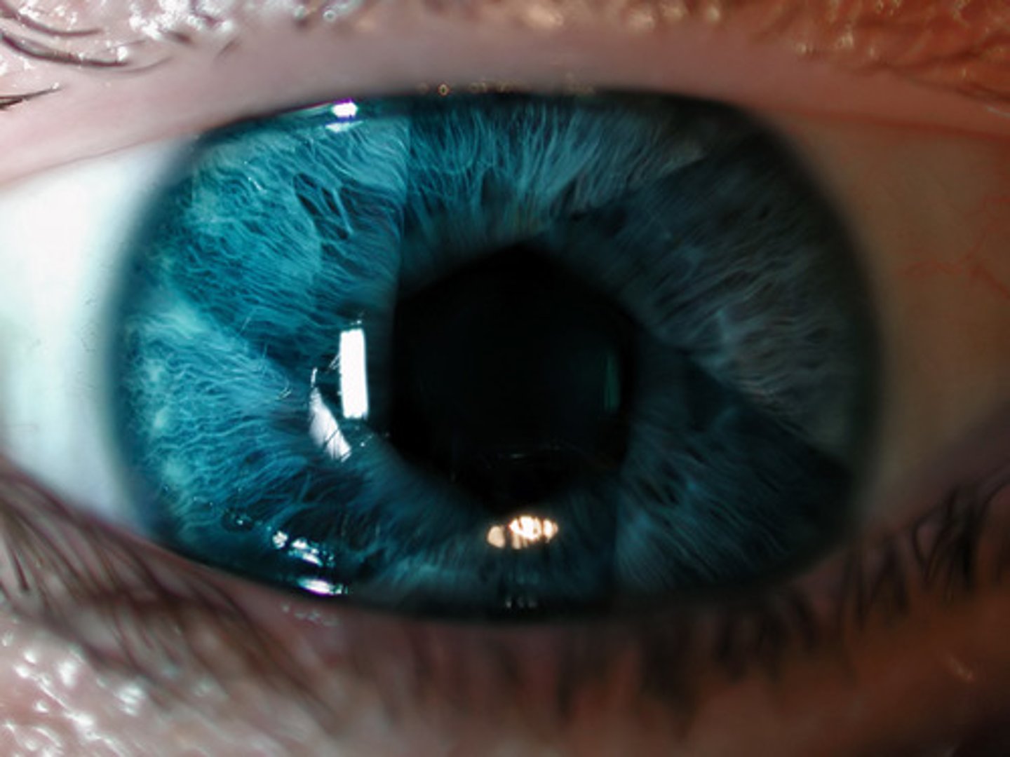 <p>eye</p>