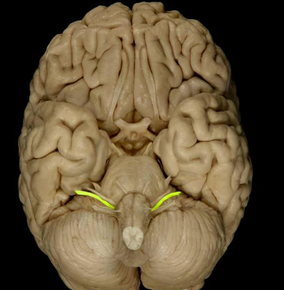 <p>List the nerve name, roman numeral, and function.</p>
