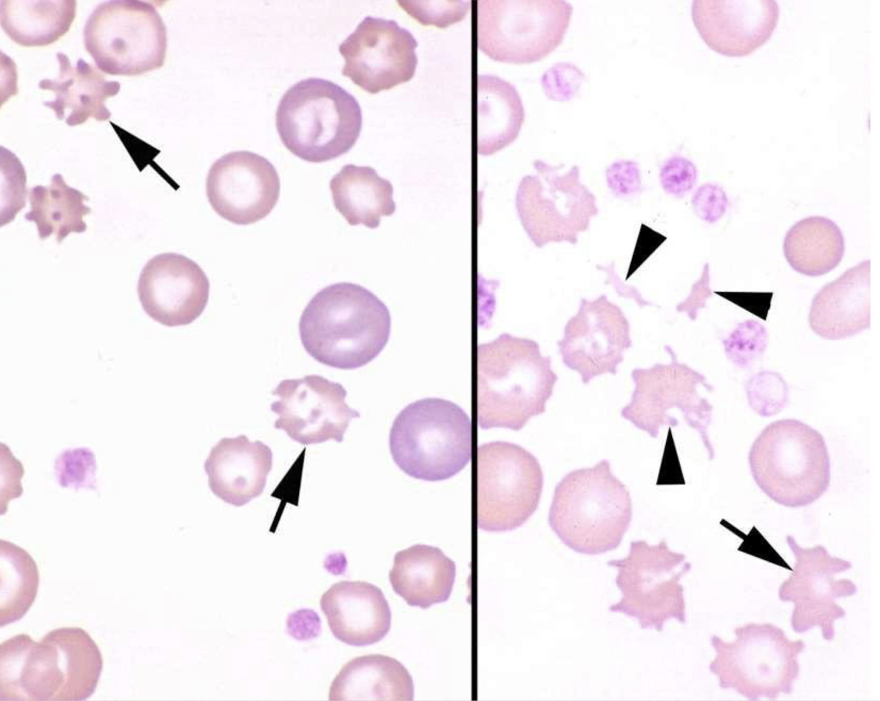 <p>what is the arrow pointing to in this image? arrow-head?</p>