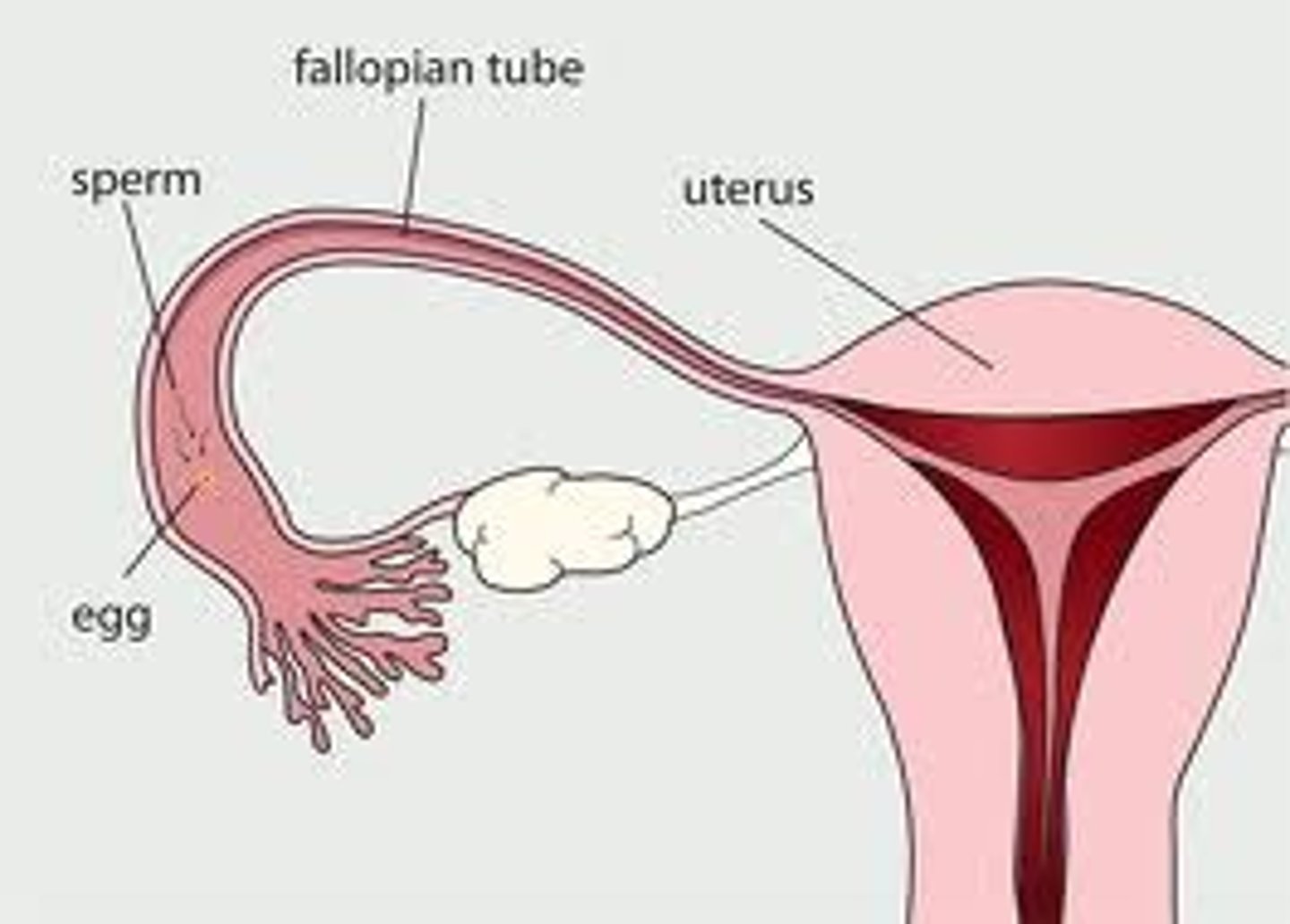 <p>fallopian tube (tube that leads from ovary to uterus)</p>