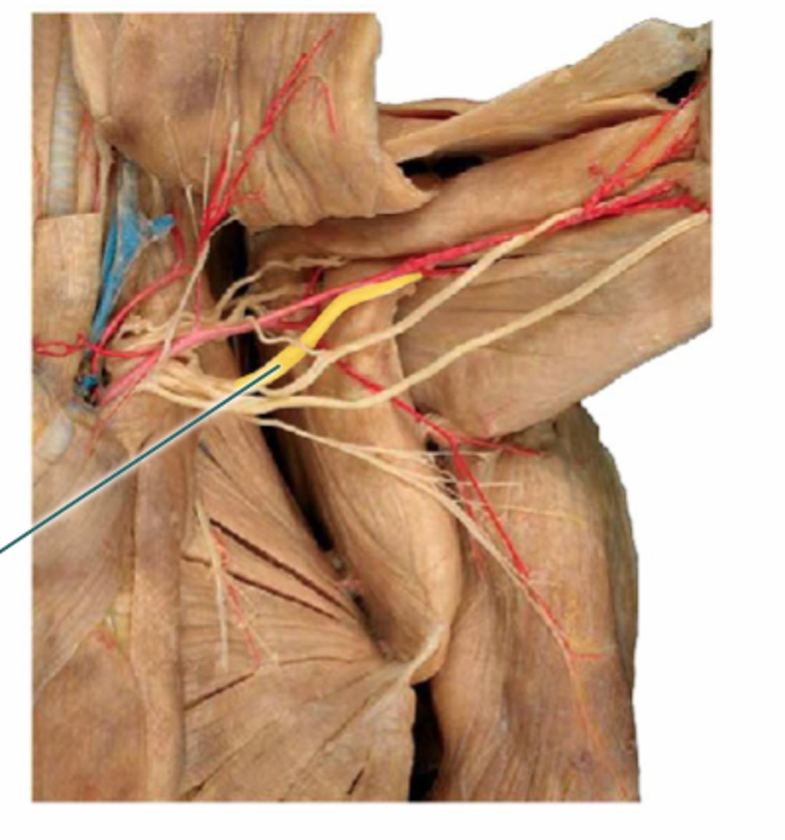 <p>thicker, often underneath tissue</p>