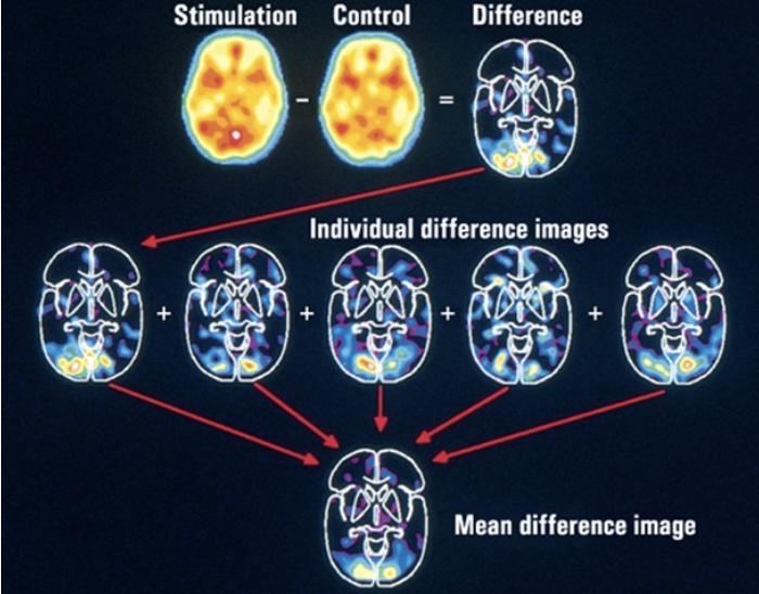 <ul><li><p>advantages: useful for targeting specific systems (ex. DA)</p></li><li><p>disadvantages: very expensive, temporally slow, poor spatial resolution</p></li></ul><p></p>