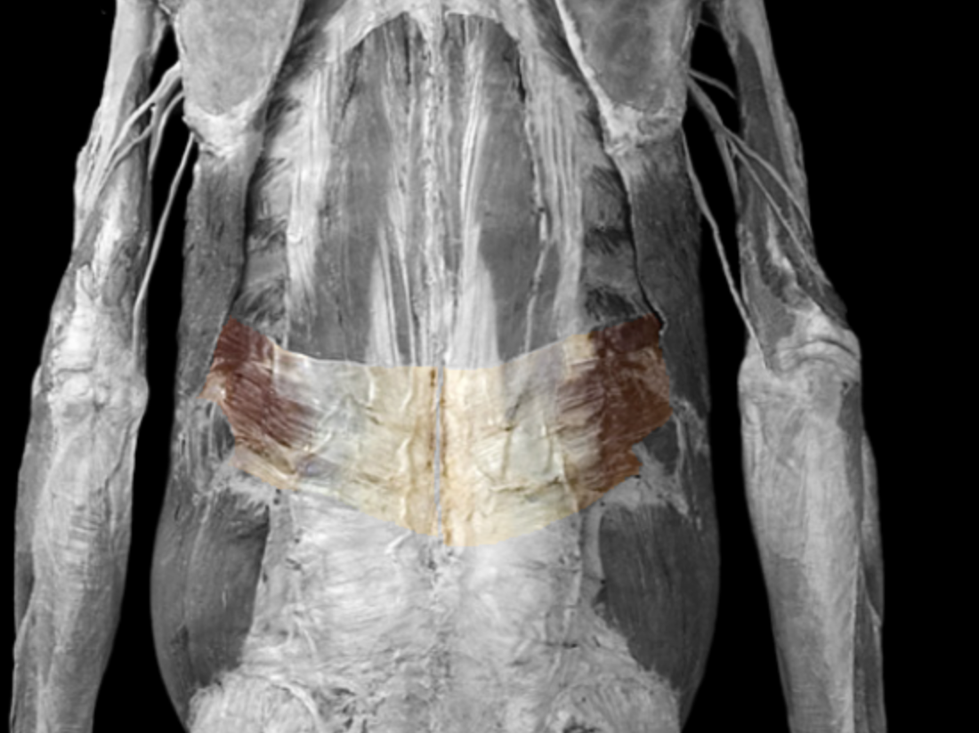 <p>What muscle is this?</p>