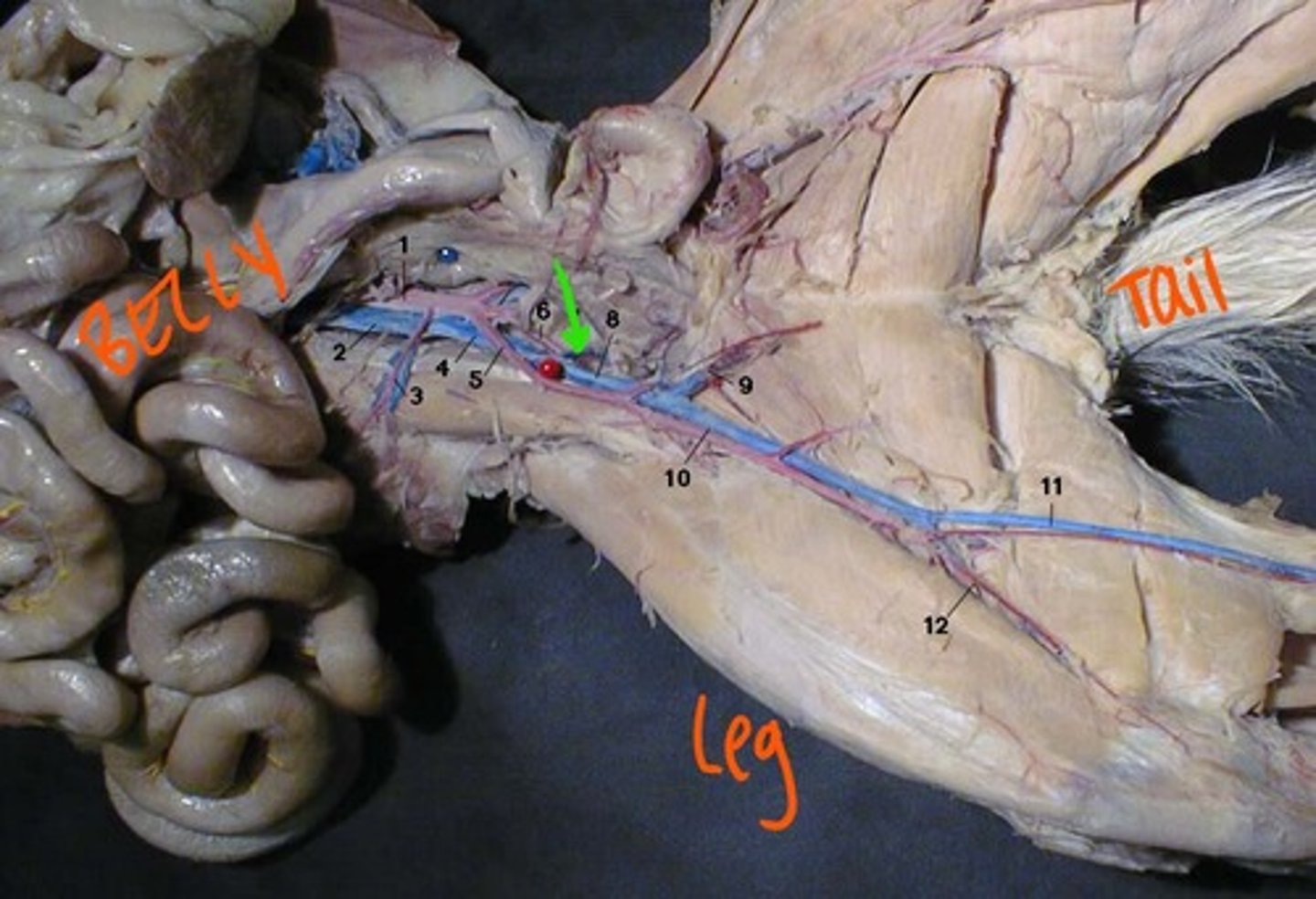 <p>identify this vein</p>