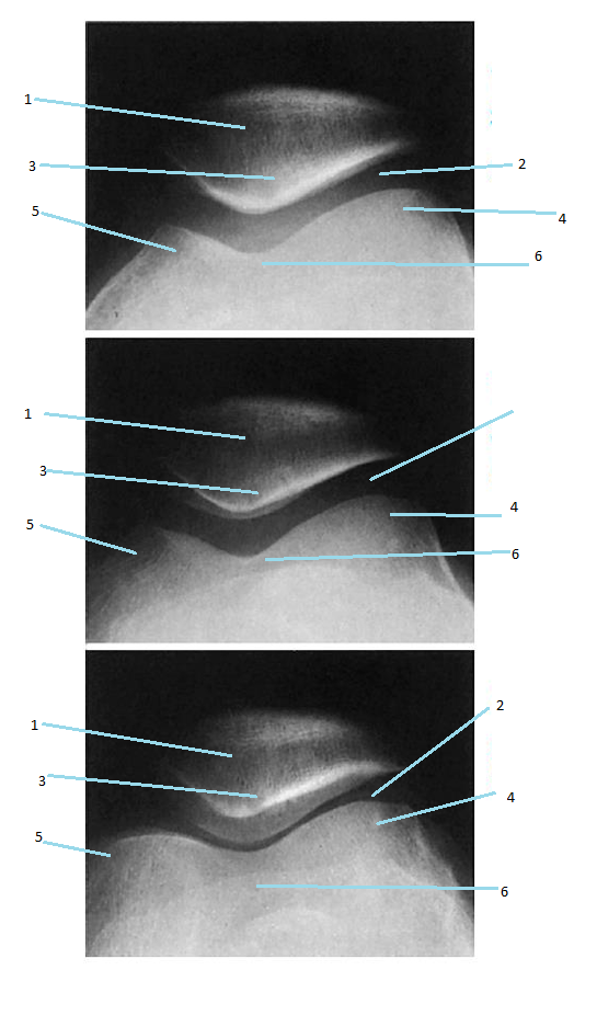 <p>5</p>
