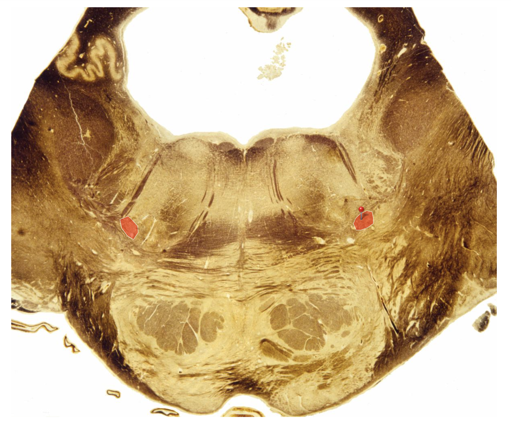 <p>Identify</p>