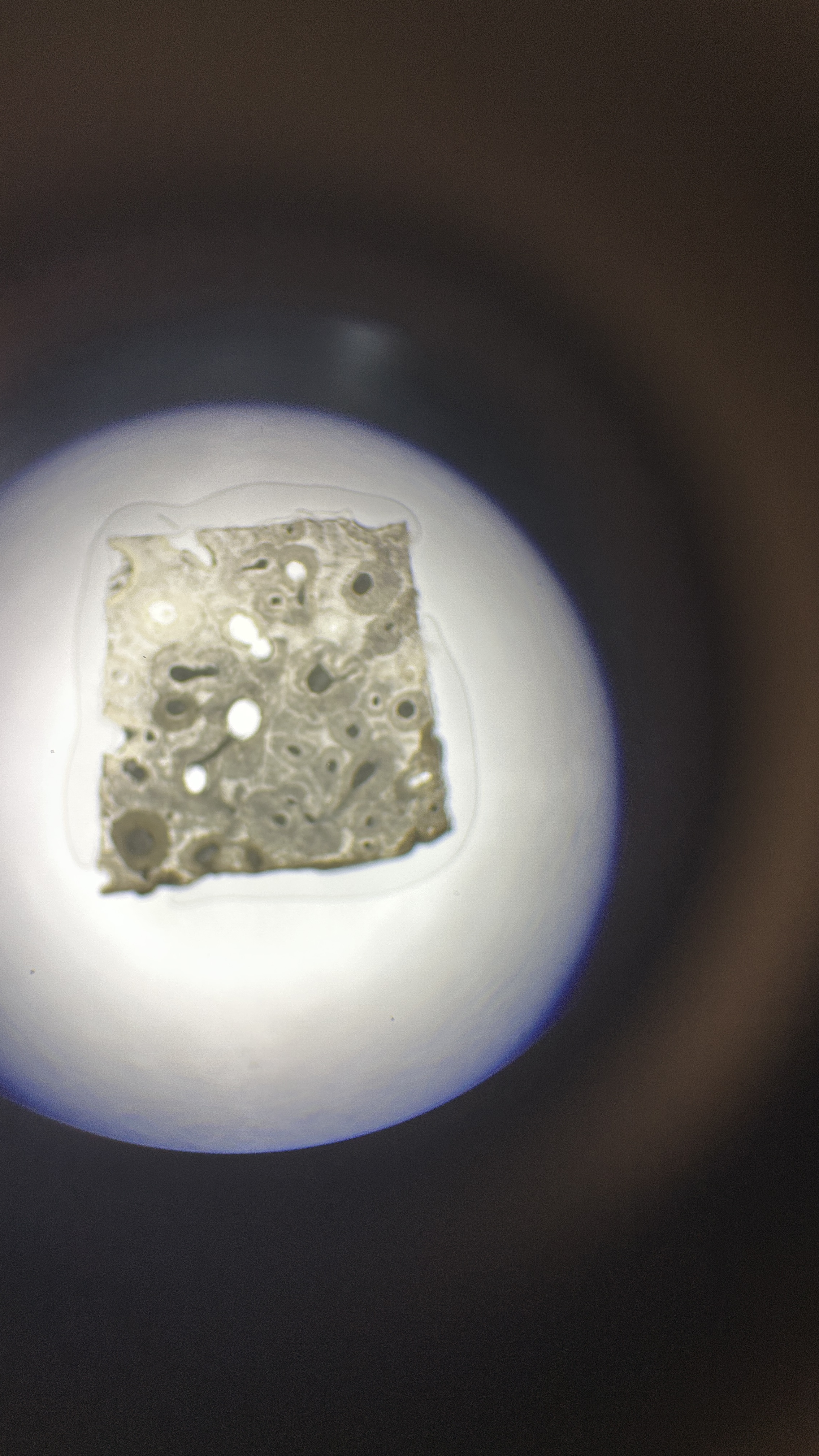 <p>What is the magnification level of the Bone?</p>