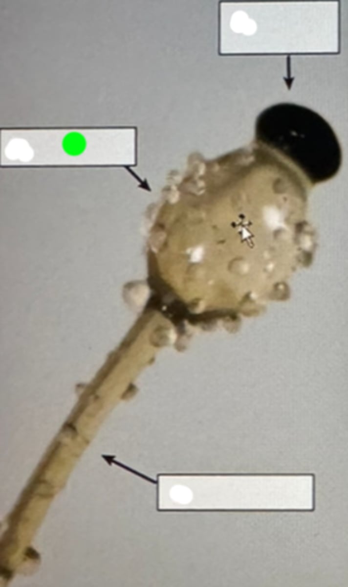 <p>A swollen, often rounded structure at the tip of certain fungal hyphae, involved in the production and storage of spores or reproductive cells.</p>