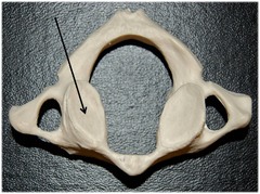 Paired and project superiorly from the junction of the lamina and pedicle