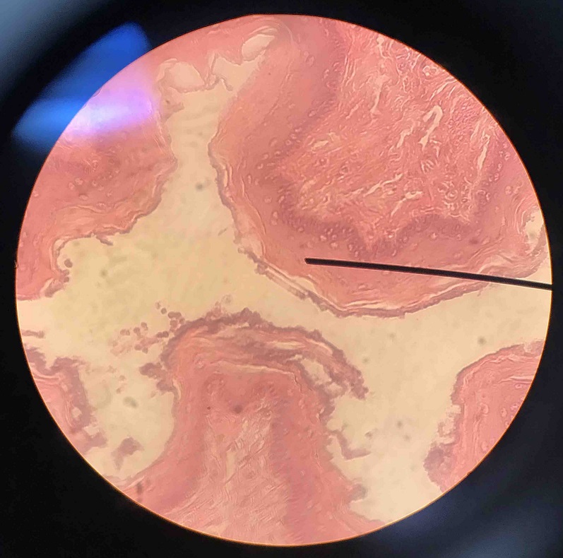 term image
