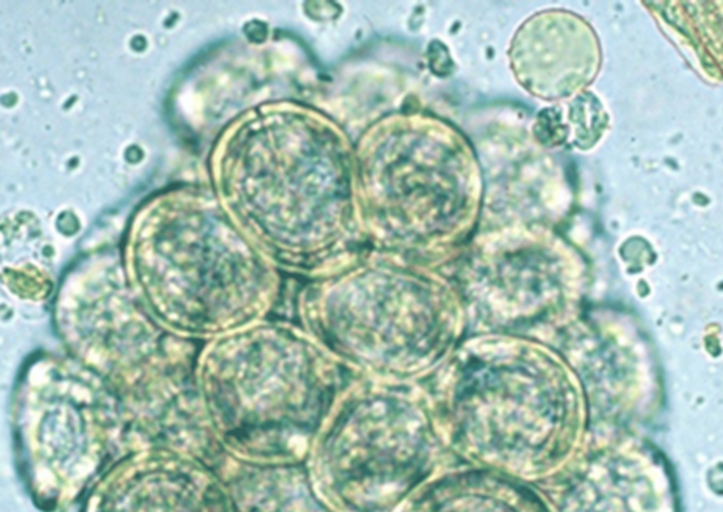 <p>Eggs that look like this were found on the fecal flotation of a beagle with persistent flea infestation. How was the beagle infected?</p>