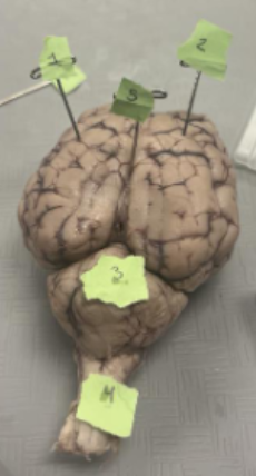 <p>What does number 2 represent on the brain?</p>
