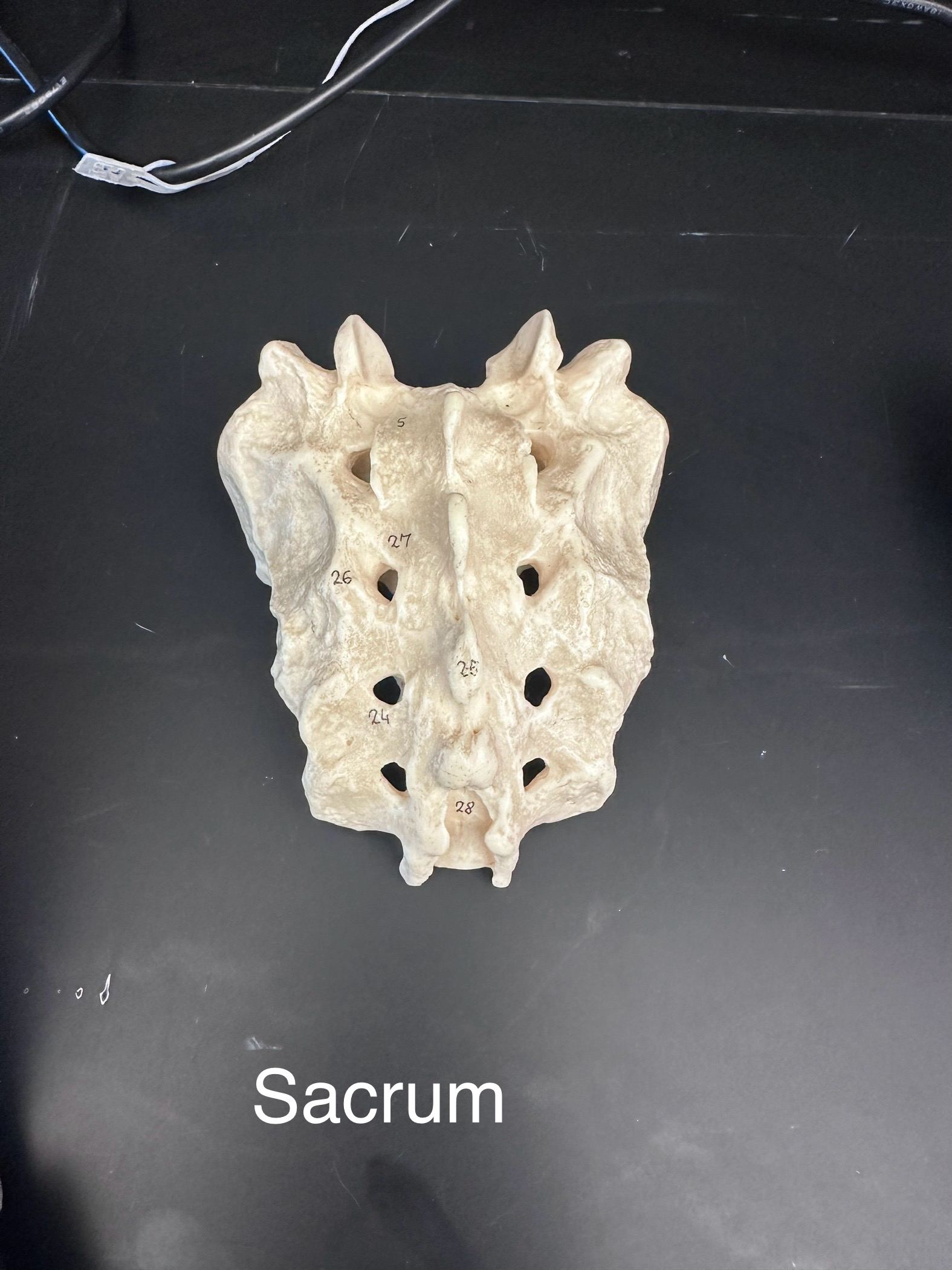 <p>Sacrum</p>