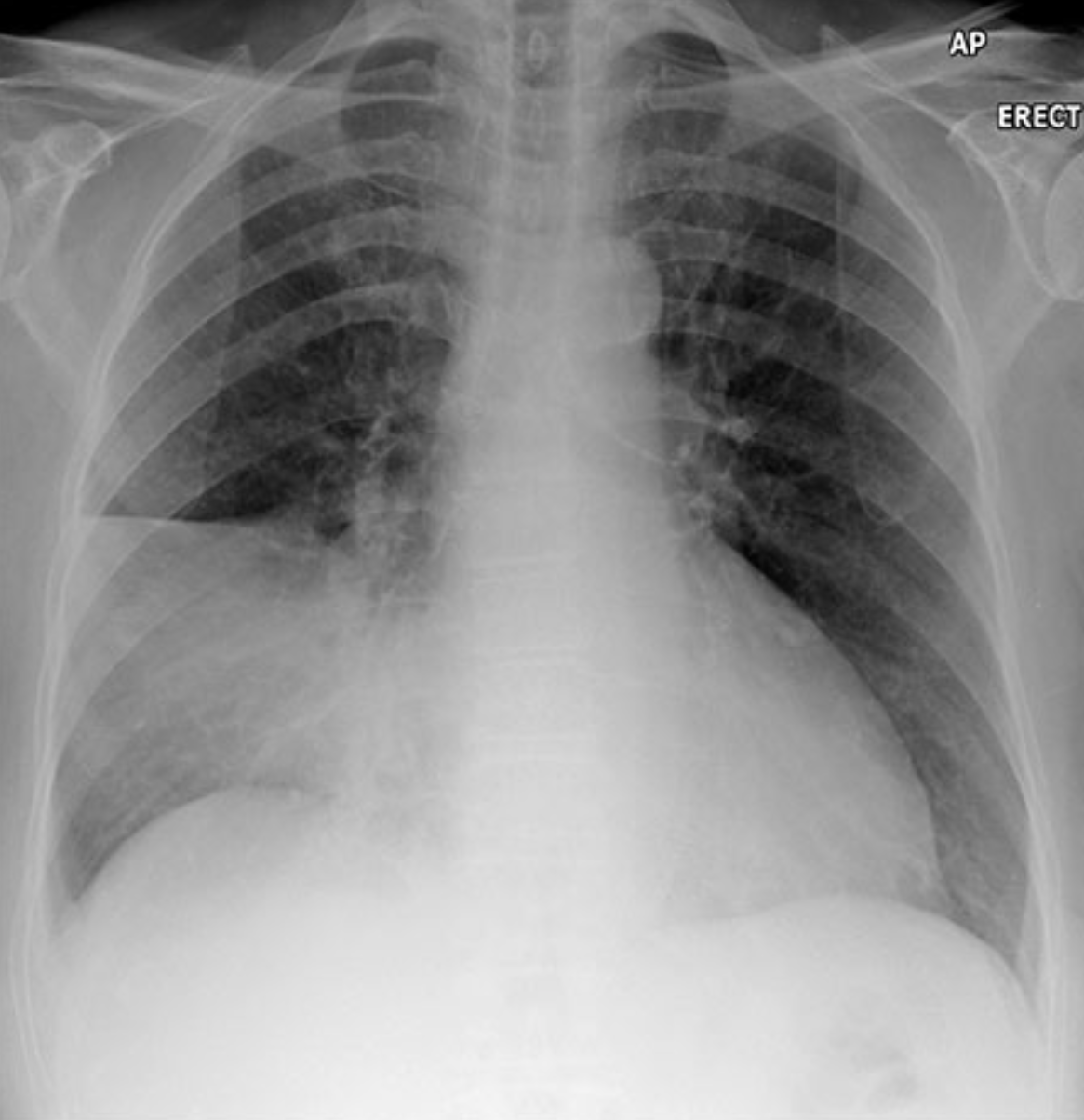 <p>Describe the abnormality demonstrated. </p>
