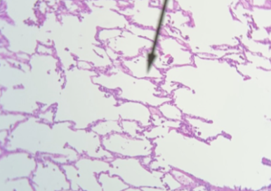 <p>what tissue is this</p>