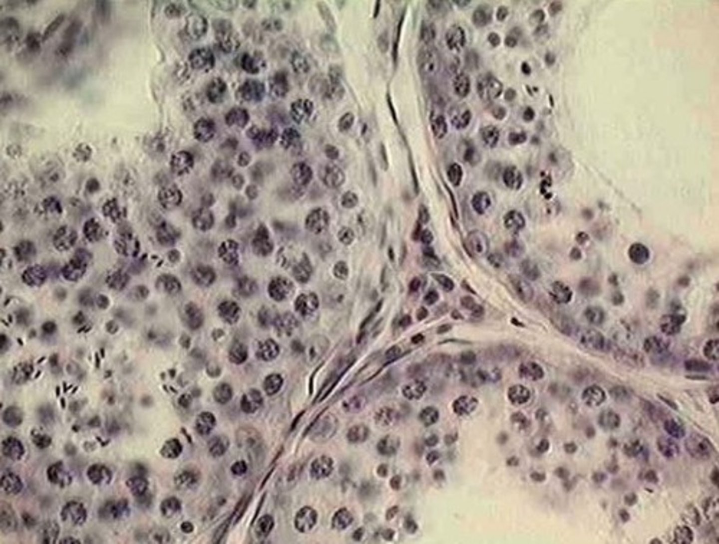 <p>seminiferous tubules of the testis</p>