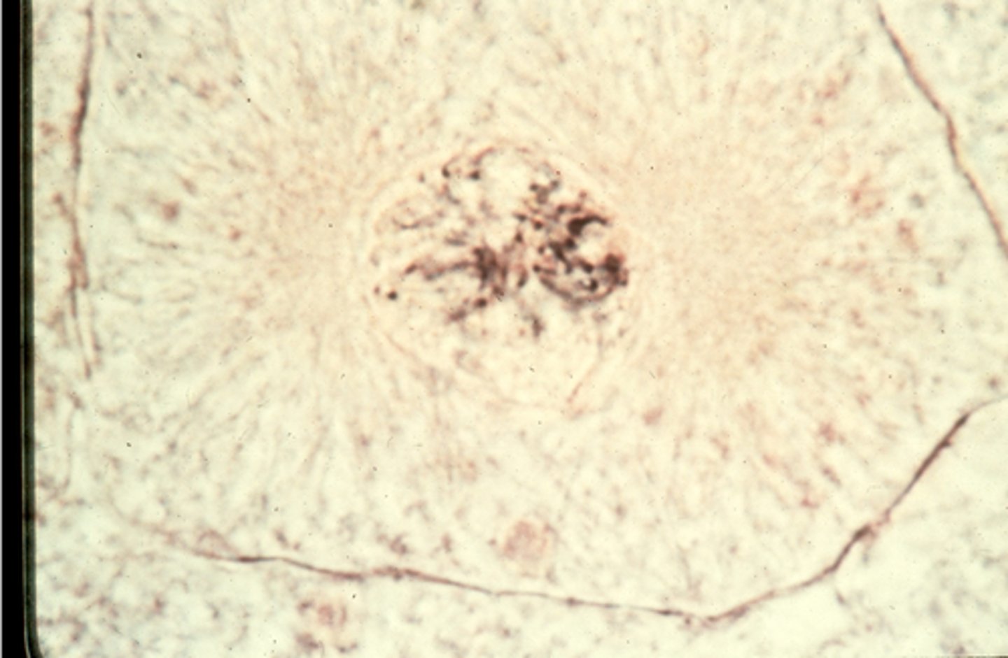 <p>This shows ________ in whitefish blastula.</p>