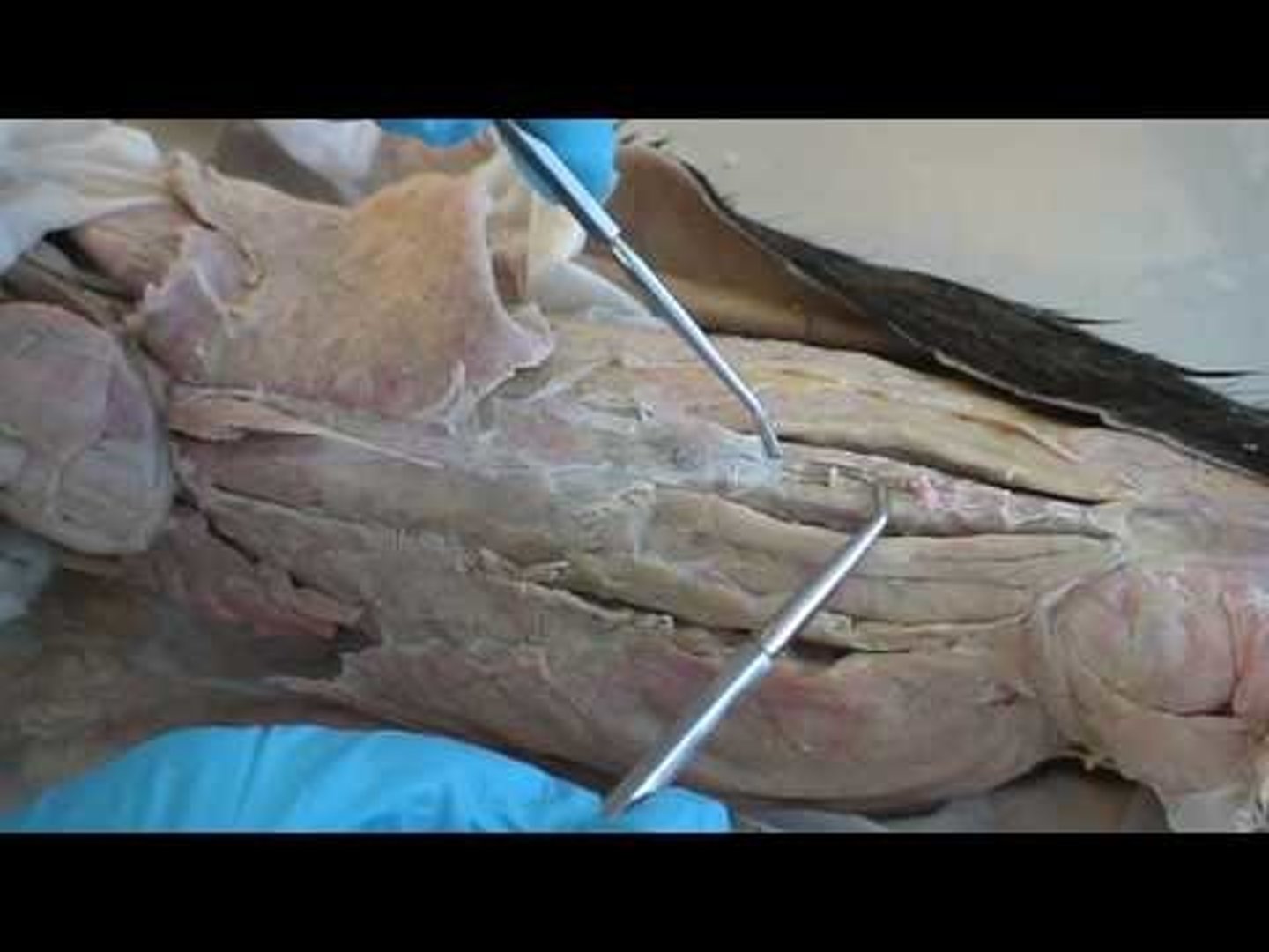 <p>-Origin Sacrum, Erector spinae Aponeurosis, PSIS, and Iliac crest</p><p>-Insertion spinous process</p><p>-Actions</p><p>=Bilateral backward extension,</p><p>= unilateral side-bending to the ipsilateral side</p><p>=rotation to the contralateral side</p>