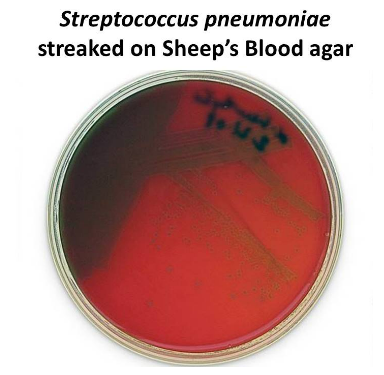 <p>Streptococcus pneumoniae exhibits a greenish appearance when grown on sheep's blood agar. What type of hemolytic pattern does this indicate?</p>