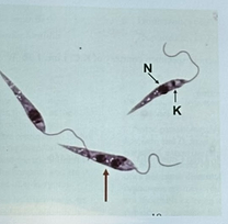 <p>Name this parasite: <br>Def host: Humans<br> Int host: Sandfly<br> Target organ:macrophages <br>Infectious stages: promastigote <br>Common disease: Kala-azar<br> Symptoms:  Hepatosplenomegaly / Animea / Immunosuppression</p>