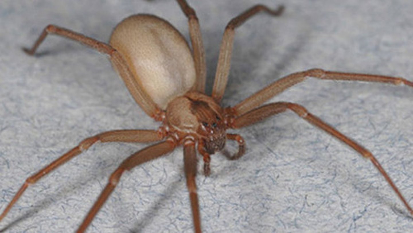 <p>- bite marks</p><p>- sharp pain (black widow)</p><p>- swelling and blistering (brown recluse)</p><p>- pain</p><p>- cramping</p><p>- nausea</p><p>- vomiting</p><p>- difficulty breathing / swallowing</p><p>- sweating</p><p>- irregular heartbeat</p>