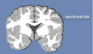 <p>areas with mostly myelinated axons</p>