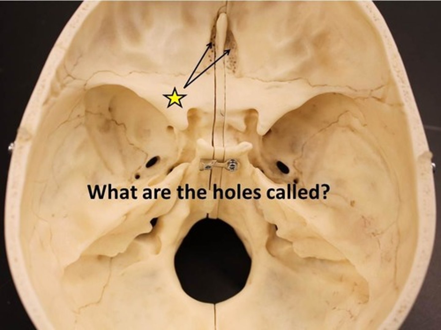 <p>hole that transmits olfactory nerve filaments</p>
