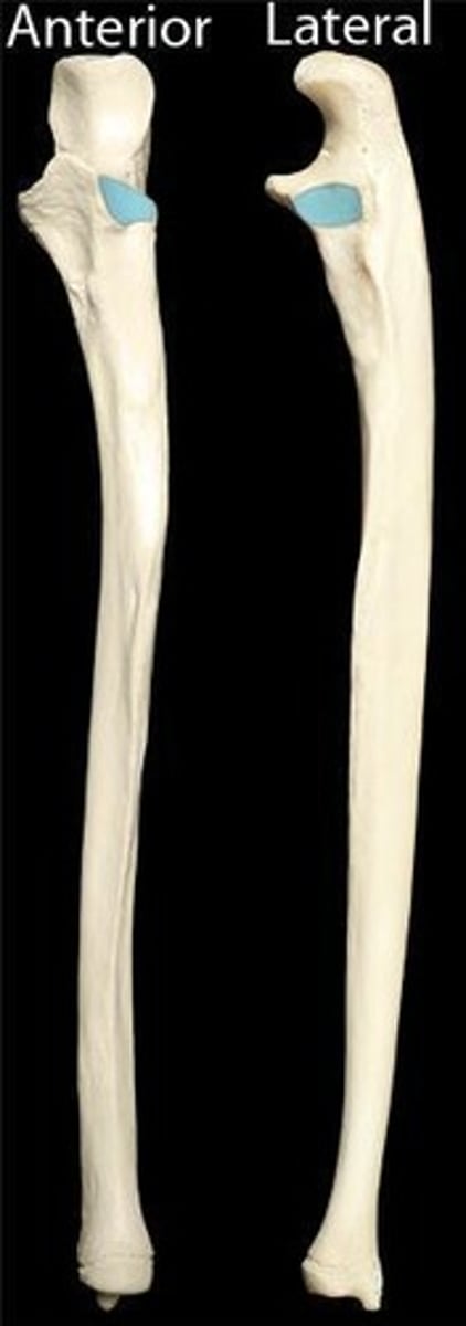 <p>ID small depression in blue</p>