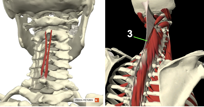 <p>mm.<em><span>&nbsp;spinales&nbsp;p</span></em>ars&nbsp;<em><span>cervicis</span></em></p><ul><li><p><strong>Proximaal:&nbsp;</strong><span>proc. spinosus C6-T2</span></p></li><li><p><strong>Distaal:&nbsp;</strong><span>proc. spinosus C2-C4</span></p></li></ul><p></p>