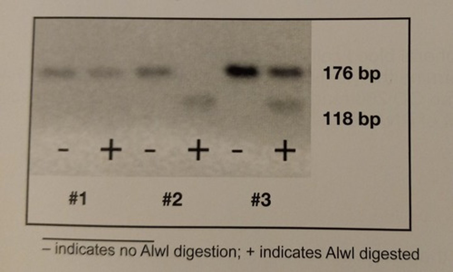 <p>Refer to the figure. An amplicon for gene X is 176 base pairs (bp) in size. A variant allele x, gives the same size amplicon but has an AIwI restriction enzyme recognition site that is not present in the amplicon arising from allele X. A PCR reaction is run on a DNA sample isolated from 3 patients. The sample is digested with AIwI after the PCR is complete and products of the digestion are resolved on a 4.0% agarose gel. Assuming all appropriate controls have worked correctly, what is the interpretation of the genotype of patient #3 with regards to alleles X and x?</p><p>a. patient is homozygous for X</p><p>b. patient is heterozygous for X and x</p><p>c. patient is homozygous for x</p><p>d. patient's genotype cannot be determined</p>