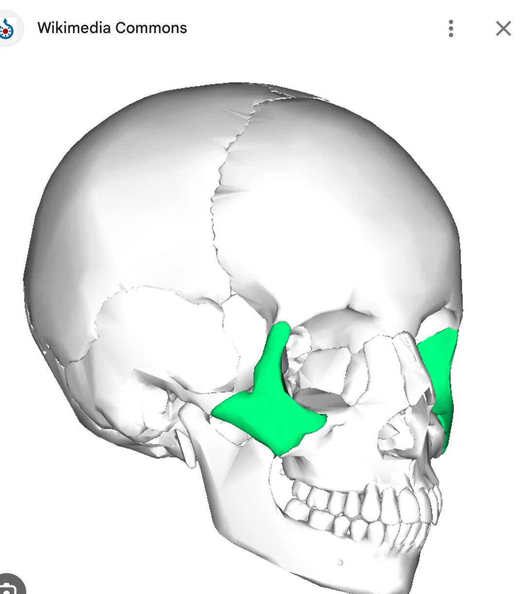 <p>Zygomatic bone (left and right)</p>