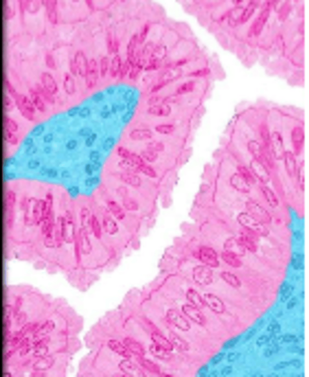 knowt flashcard image