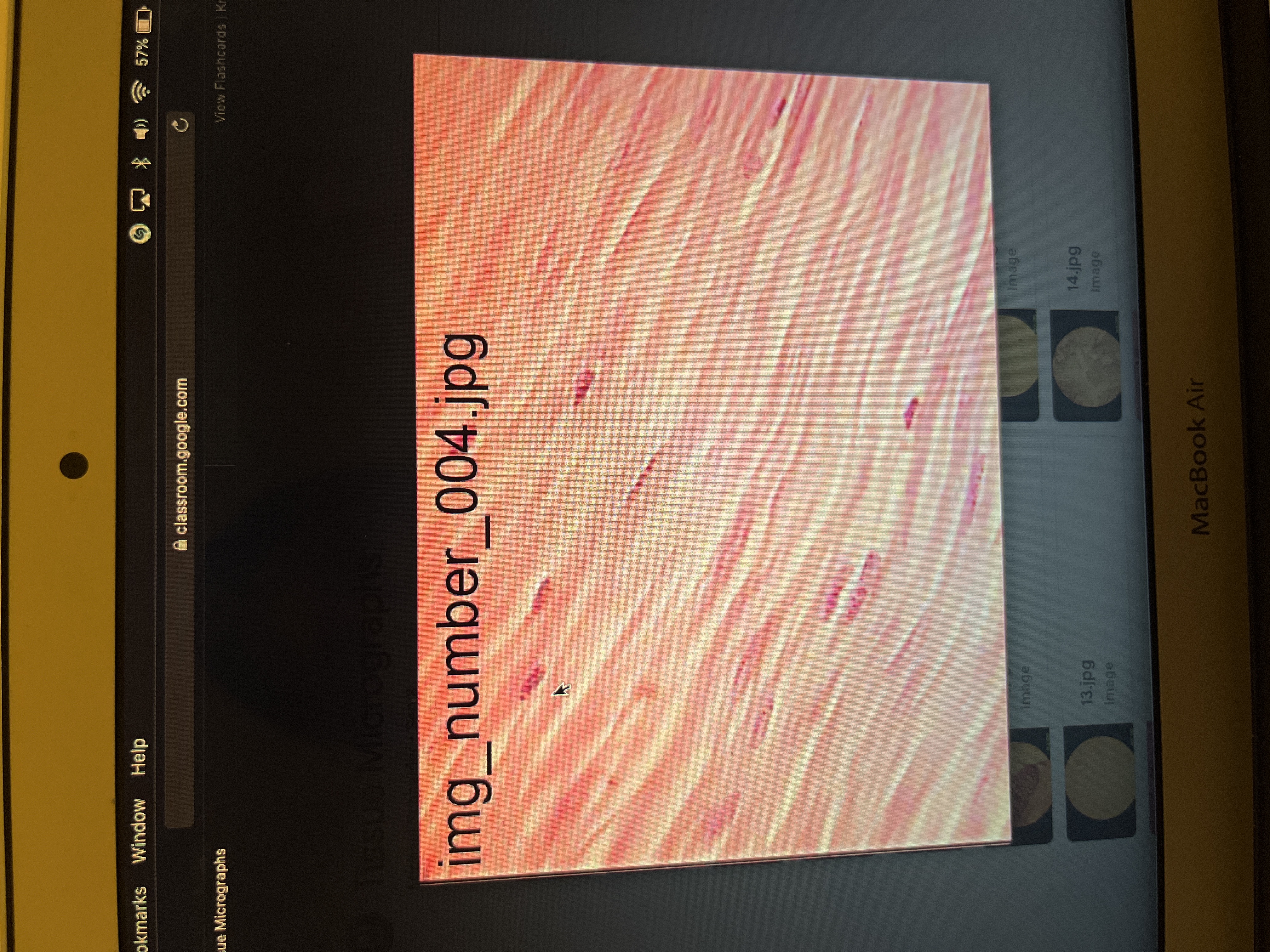 Location:attached to bone by tendons
Function: motion, posture, heat production, protection 