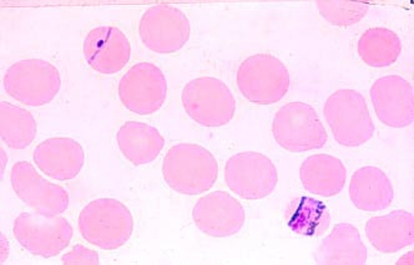 <p>"Band form" trophozoites</p>