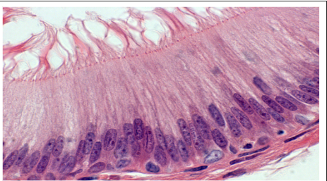 <p>Function: Moves mucus </p><p>Location: Reparatory Tract Lining </p>