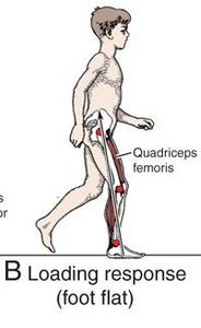 hip remains in 30º flexion
-thigh in 20º flexion
