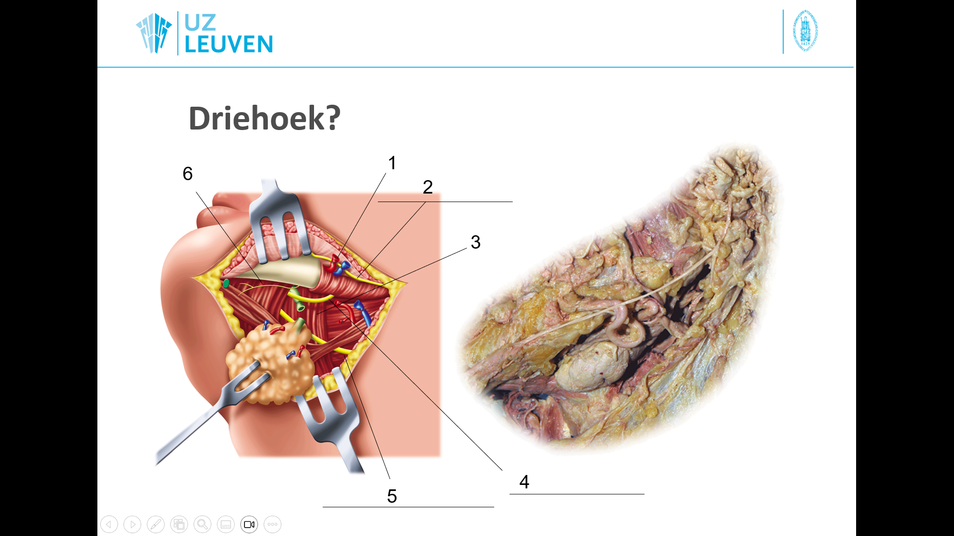 <p>welke driehoek? </p>