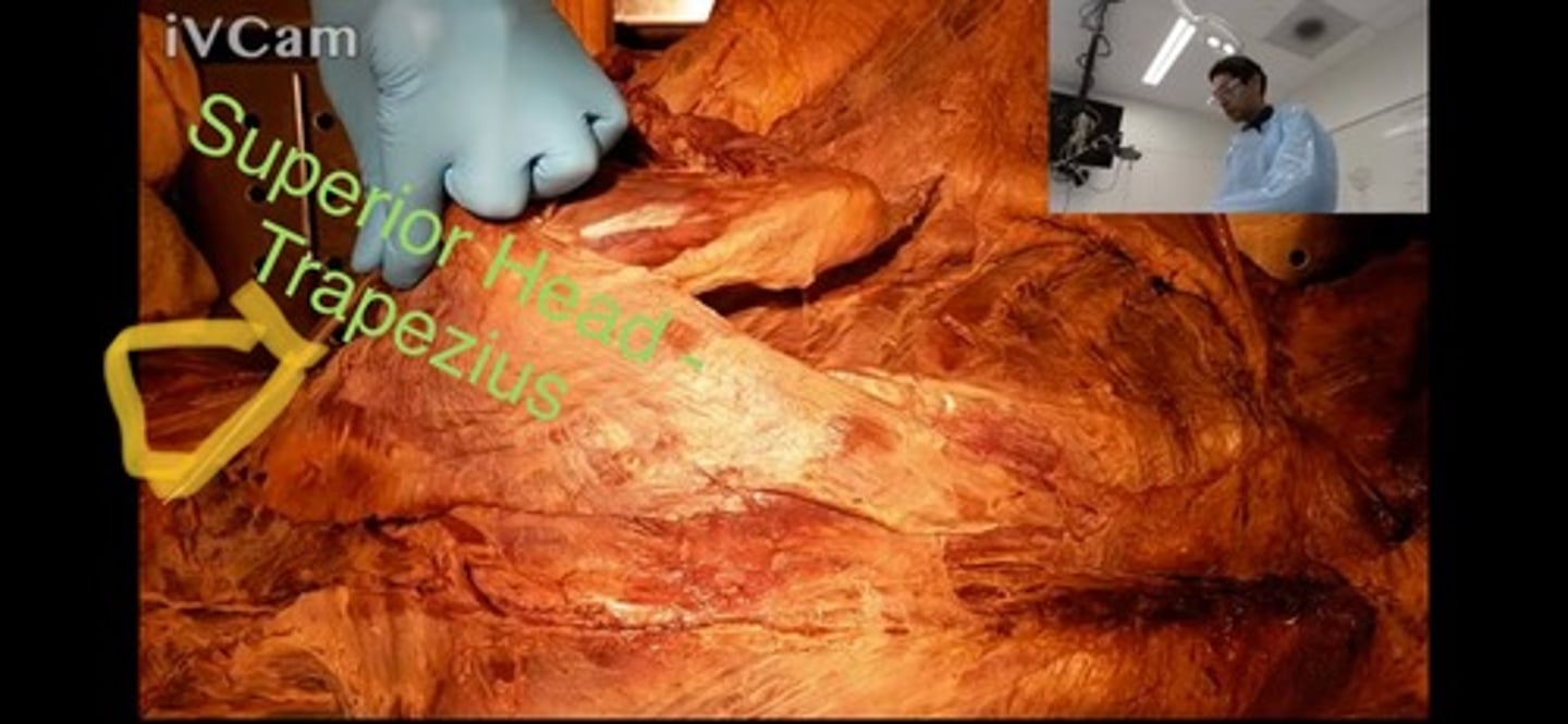 <p>origin - external occipital protuberance and superior nuchal line of occipital bone, nuchal ligament, spinous process of C7</p><p>insertion - posterior aspect of lateral one third of clavicle, acromion of scapula</p><p>function - elevate, retract and upwardly rotates the pectoral girdle, laterally flexes and extends neck</p>