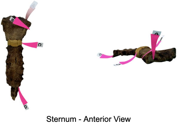 <p>Identify the costal facet for rib 1</p>