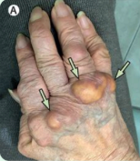 <p>On pressure points</p>