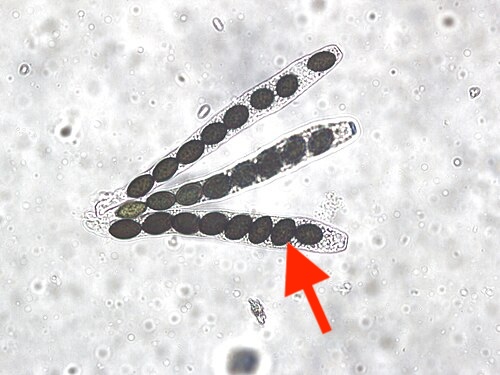 <p>What is the arrow pointing to?</p>